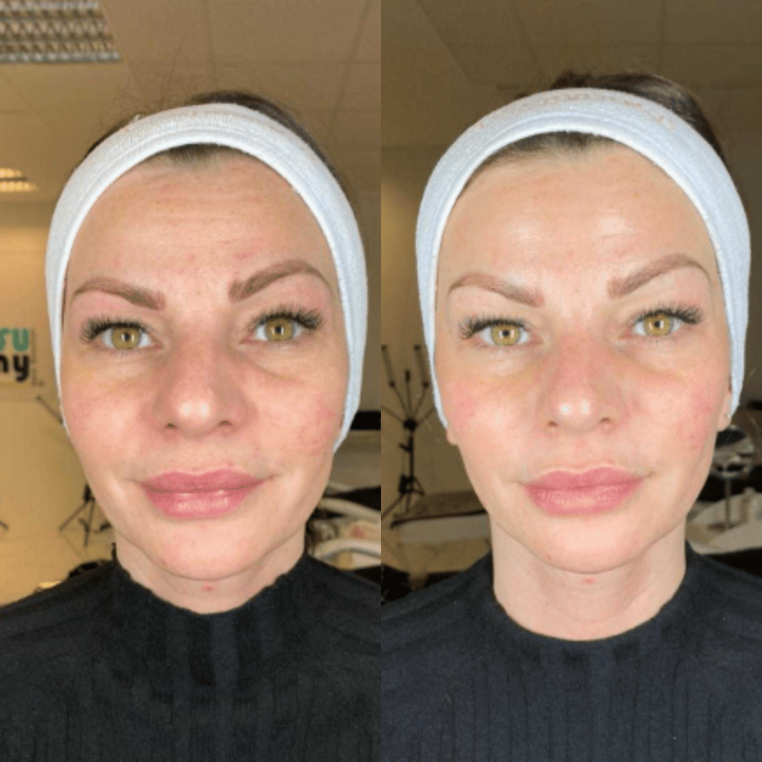 Fiorenza® Mascarilla Boost de Colágeno