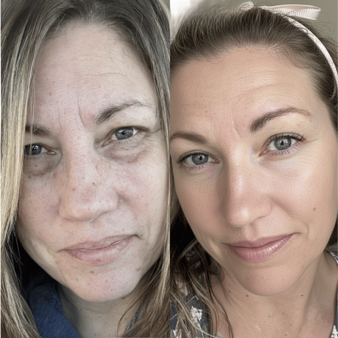 Fiorenza® Mascarilla Boost de Colágeno