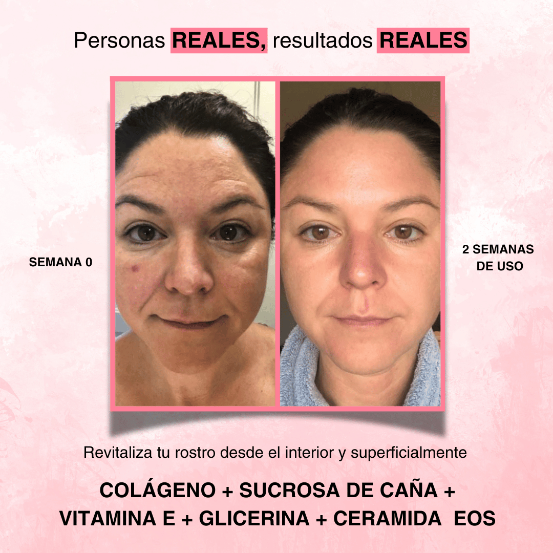 Fiorenza® Mascarilla Boost de Colágeno