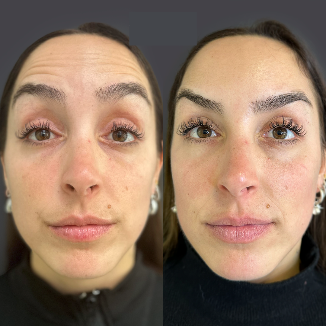 Serum Noni Fiorenza®️