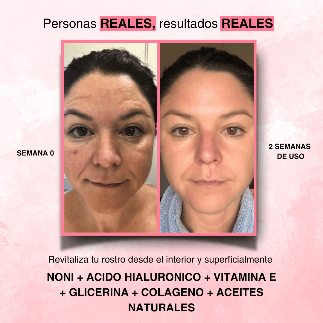 Serum Noni Fiorenza®️
