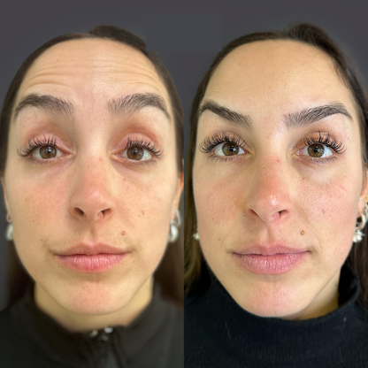 Serum Noni Fiorenza®️
